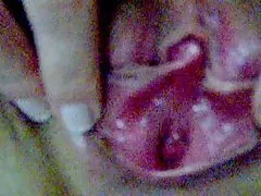 Si tratta con vibratore 1